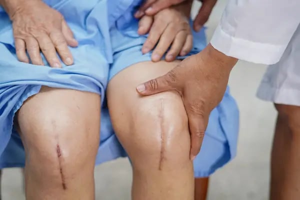 Orthopedics